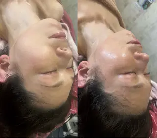 美容鍼灸サロン mahoroba院長のエステ・リラクイメージ