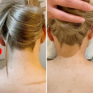 うなじ脱毛/美肌脱毛 LABELのエステ・リラクイメージ