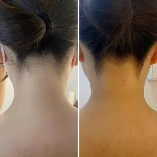 うなじ脱毛/美肌脱毛 LABELのエステ・リラクイメージ