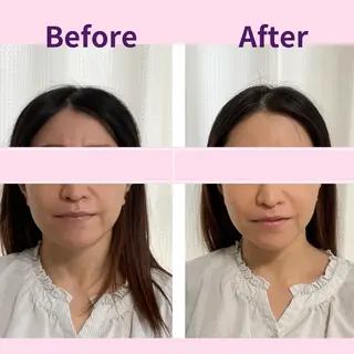 小顔エステサロン ハピハピのエステ・リラクイメージ