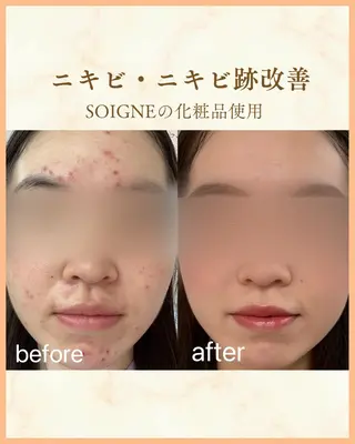 CPサロンビバーチェ所属・CPサロン ビバーチェのエステ・リラクイメージ