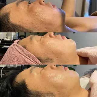 Meetite 小林のエステ・リラクイメージ