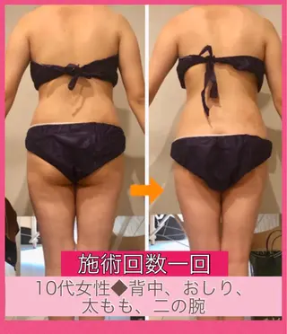 ロング カラー パーマ ヘアアレンジ メンズ キッズ ネイル マツエク・マツパ ‍痩身＆ボディ 結果出し🌟丹野のエステ・リラクイメージ