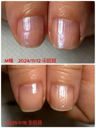 ネイル 自爪育成/深爪矯正salon fam_【ネイルケア・エステ脱毛】所属・chika chikaのネイルデザイン