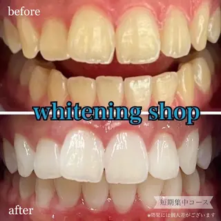 ホワイトニングショップ桜木町店所属・ホワイトニング ショップ桜木町店のエステ・リラクイメージ