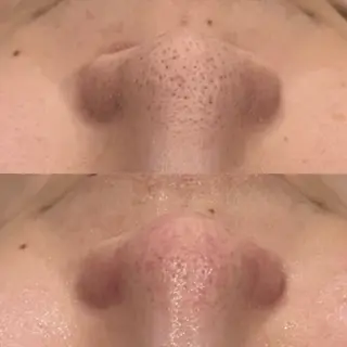 【しみ毛穴専門店】beautysalon Ankh所属・しみ毛穴専門店 Ankh 平田のエステ・リラクイメージ