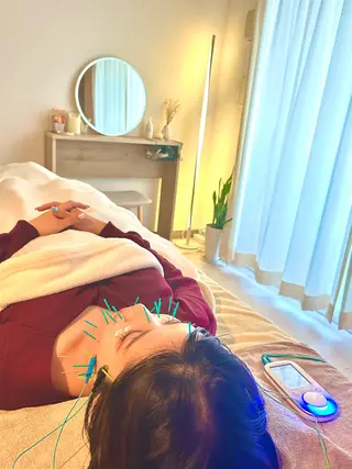 鍼灸•マッサージサロンCalfa所属・《美肌･小顔》美容鍼 ＆マッサージ＊MEIのエステ・リラクイメージ