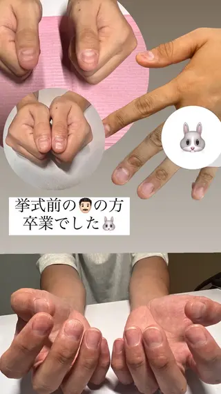 メンズ ネイル 爪ケア/深爪 自爪育成 🐰えむのネイルデザイン