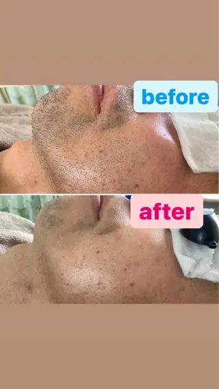 美肌脱毛&光フェイシャルサロン　ギュネシ所属・脱毛&光フェイシャル サロン　ギュネシのエステ・リラクイメージ