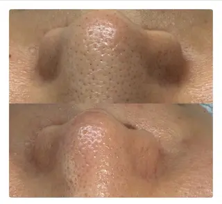 駒月 明日香の眉毛・アイブロウイメージ