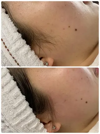 Lien所属・Lien .nahoのエステ・リラクイメージ