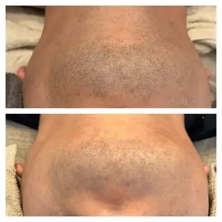 総合エステサロン 肌活のエステ・リラクイメージ