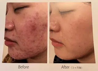 ホワイトビューティ サロンのエステ・リラクイメージ