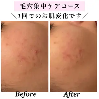 Bellesthe （ベルエステ）のエステ・リラクイメージ