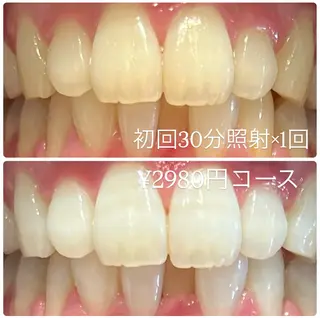 PLATINUM Beauty 横浜店所属・ホワイトニングルーム 横浜店のその他イメージ