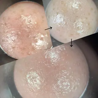 メナードフェイシャルサロン　福山東手城所属・耳ツボ/エステ/ CHIHIROのエステ・リラクイメージ