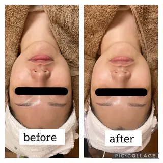 肌悩み改善 〜エステサロン〜のエステ・リラクイメージ