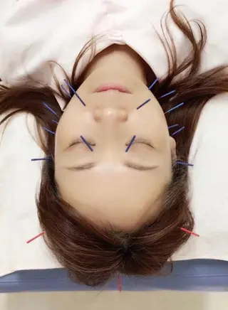 やまだ鍼灸接骨院（やまだしんきゅうせっこついん）所属・山田 晃のエステ・リラクイメージ