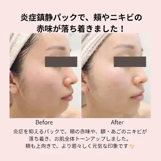 PRETTIEST SHINE所属・山田 浩子のエステ・リラクイメージ