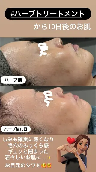 LiZA エステティックサロンのエステ・リラクイメージ