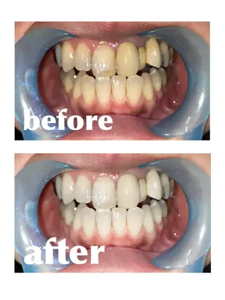 beauty salon nana所属・beauty salon nanaのエステ・リラクイメージ