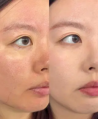 ネイル aliaハイフ&水光ジェットサロン所属・aliaハーブ水光店 エステティシャン募集のエステ・リラクイメージ