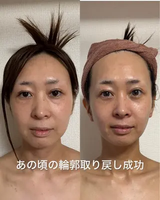 透明感の肌Lino malieのエステ・リラクイメージ