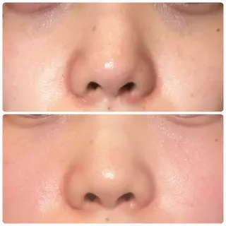 青山・表参道/ 💎肌質改善/inoのその他イメージ