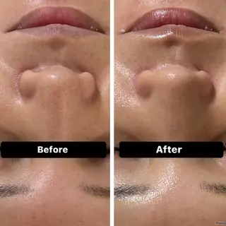 脱毛＆Beauty salon IILA所属・垢抜けお手伝い💖 Sakuraの眉毛・アイブロウイメージ