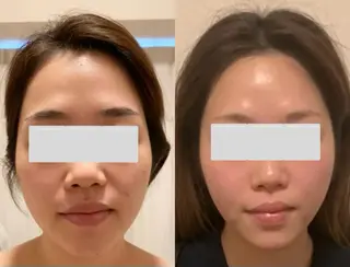 a  room salonのエステ・リラクイメージ