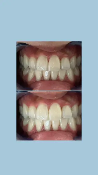 セルフホワイトニングサロンエクシアホワイト倉敷店所属・ecxiawhite 倉敷店のエステ・リラクイメージ