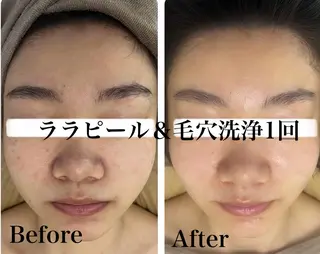 《美肌&小顔サロン》 Masqueradeのエステ・リラクイメージ