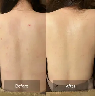 for woman所属・森 美優のエステ・リラクイメージ