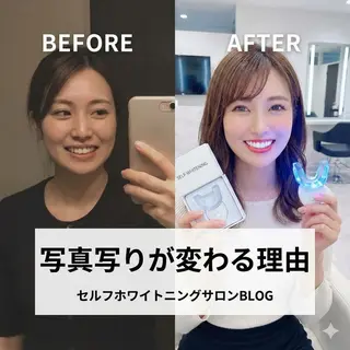 ショート パーマ ホワイトニングサロン nico西葛西店のその他イメージ