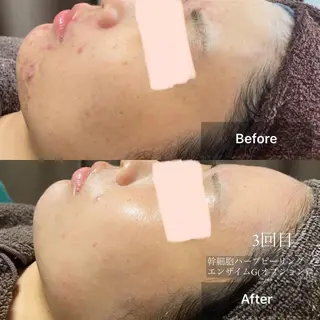 メンズ キッズ 美肌・リラクゼーションサロンLu,Mie所属・美肌と癒しのサロン Lu,Mieのエステ・リラクイメージ