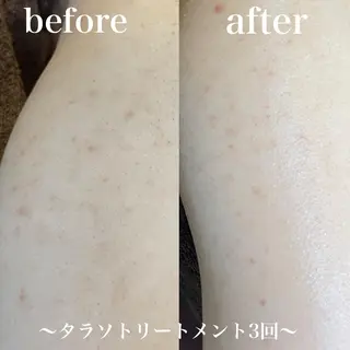 浜野 恵美のエステ・リラクイメージ