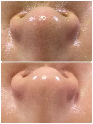 private salon  Dea_maris シュガーリング＆パーソナルボディケア所属・シミ改善・韓国肌管理 ボディメイク痩身のその他イメージ