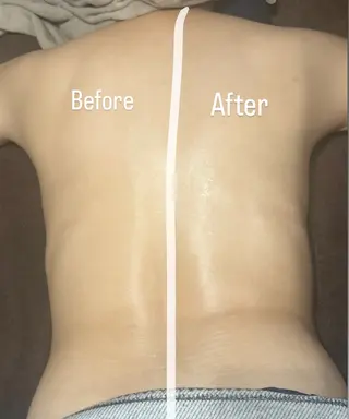 浮腫|肩こり|張り 日々の疲れを解消⭐️のエステ・リラクイメージ