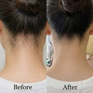 脱毛×肌管理サロン ルネルのエステ・リラクイメージ