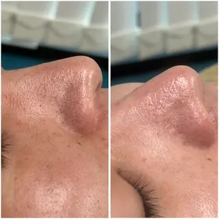 re.make所属・小顔美肌💖痩身☃️ ユキナ🤍のエステ・リラクイメージ