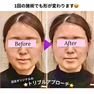 小顔矯正 natsuのエステ・リラクイメージ