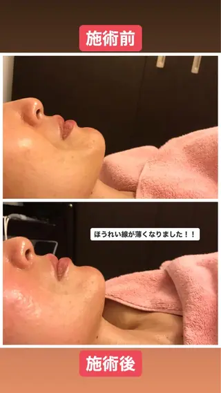 佐藤 加奈のエステ・リラクイメージ