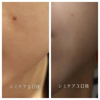 🅖🅤🅩🅔🅛 salonのエステ・リラクイメージ