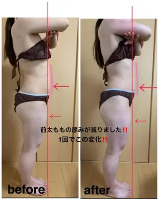 痩身/脱毛/ネイル HARUKAのエステ・リラクイメージ