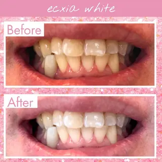 セルフホワイトニングエクシアホワイト草加店所属・セルフホワイトニング エクシア草加店のその他イメージ