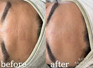 メンズ 毛穴&ニキビ専門　Bonita Ange恵比寿所属・毛穴ニキビ専門 BonitaAngeのエステ・リラクイメージ