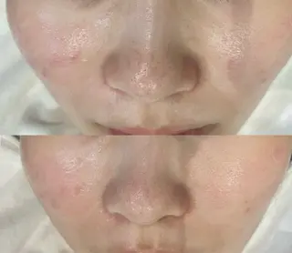 DeI'm   名古屋栄所属・小林 玲菜のエステ・リラクイメージ