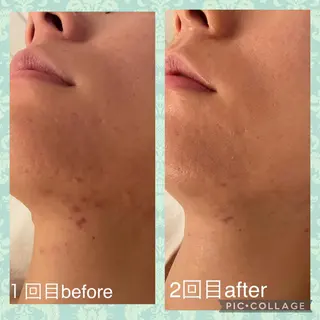 Serenity salonのエステ・リラクイメージ