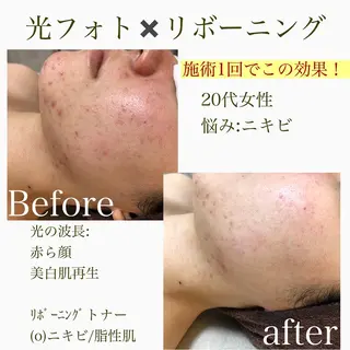 美肌脱毛と癒しのﾌﾟﾗｲﾍﾞｰﾄｻﾛﾝ。gratia~ｸﾞﾚｲﾃｨｱ~所属・gratia ~ｸﾞﾚｲﾃｨｱ~のエステ・リラクイメージ