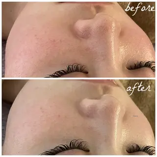 メンズ メナード岐阜茜部 杉浦のエステ・リラクイメージ